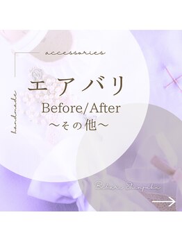 美バリ 新宿店(美BARI)/エアバリはボディケアにも◎