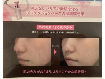 アリュール(Allule)/保護美容液で守る