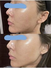 ナラビューティー(NARA BEAUTY)/韓国肌管理！ララピール