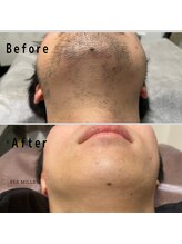 パーミル 楠葉店(per mille‰)/Before/After