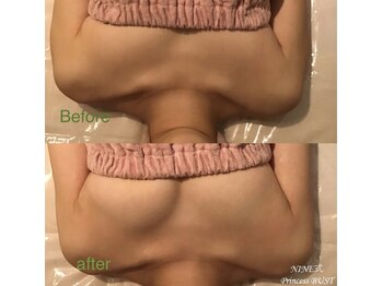 ベッピン(Beppin)/静岡バストケア/静岡育乳