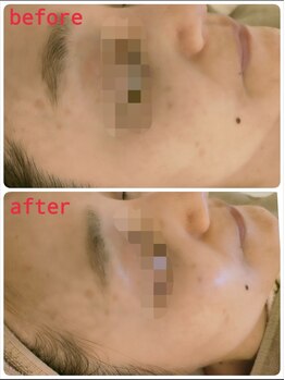 サロンドットブレスドットケイ(salon.bless.k)/年齢からくる肌疲れ