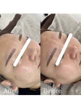 ラ フルール(La Fleur)/エアバリフェイシャル