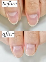 ニコワイズネイル(Nico Y's Nail)/【自爪育成コース】