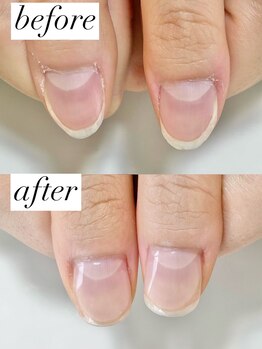 ニコワイズネイル(Nico Y's Nail)/【自爪育成コース】