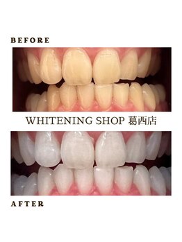 ホワイトニングショップ 葛西店/歯科提携 ホワイトニング専門店