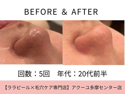 ア クーユ 多摩センター店の写真