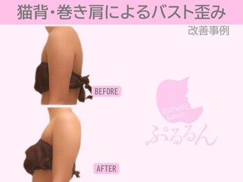 ぷるるんエステ/バストアップ/肩こり/リンパ