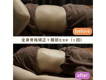 落ち着いた個室のエステルームにて骨格から整えるエステ☆