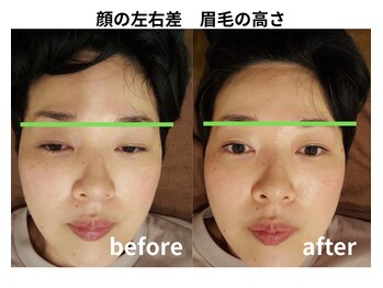 リファイン整体院 国分寺店/小顔、骨盤、ヘッドスパ、整体