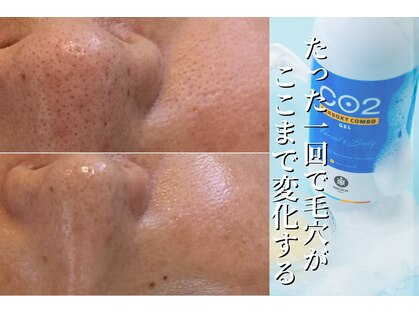 エトレ(etre)の写真