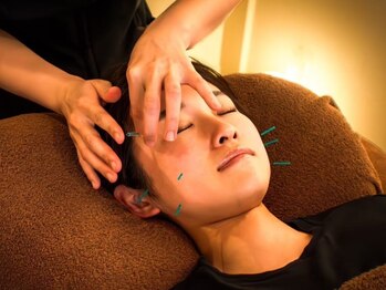美容鍼灸サロン respirer 麻布十番【美容鍼・ほうれい線改善・肩こり眼精疲労】の写真/美容鍼でほうれい線・たるみ・むくみを改善。表情筋から引き上げる本格リフトアップで若々しい印象へ