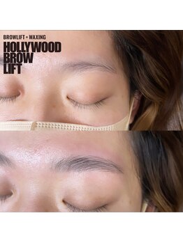 リンクス(links)/ハリウッドブロウリフト