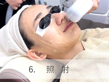 ラウレア 松山店(LAULEA)/照射を行いコラーゲン生成を促す