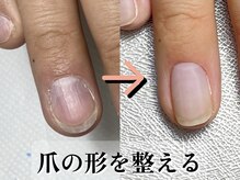 エヌプロテクト(N.Protect)/