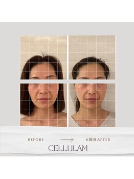 セル ノ ネ(Cell ne)/食いしばり緩和