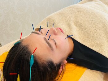 スイッチオン接骨院 はり灸院/ スイッチオン接骨院・はり灸院