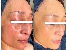 白雲木/年齢に伴うエイジングケア