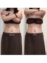 ジョワイユ(Joyeux)/腸の位置でお腹は変わる