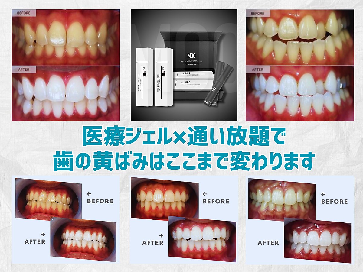 スマイルホワイト 赤羽店｜ホットペッパービューティー