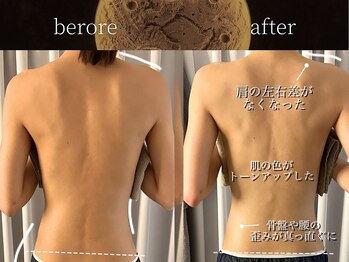 リムーン(REMOON.)/施術後の効果★