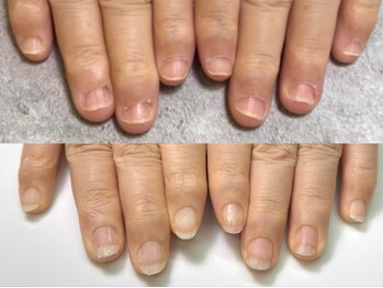 グラシナ 鳥丸店/(深爪/長さだし/フィルイン/)