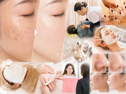 ブレア(BLAIR)の写真