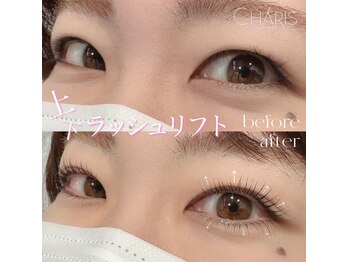 カリス(CHARIS)/上下ラッシュリフト