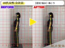 幸せのもり整体院/【40代女性／会社員】Tさん