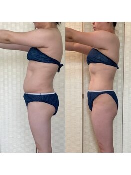 セブンドロップス(7drops)/産後太りもおまかせ