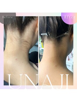 929 アイラッシュアンドビューティーサロン/うなじWAX