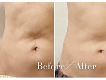 《お腹集中ケア》すっきり引き締め