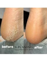 #けあなちゅらる/足裏角質ケア