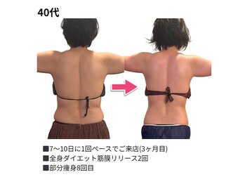 アマテ(Amate)/４０代のダイエットエステ