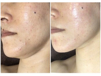 クレビア(CREBIA)/