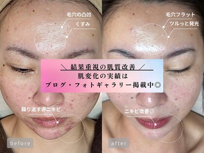 クリア 栄生(CLEAR)の写真