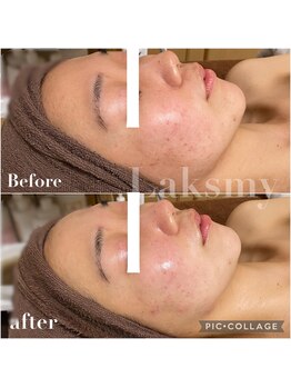 ラクシュミー ナチュラル(Laksmy NATURAL)/お客様ビフォーアフター