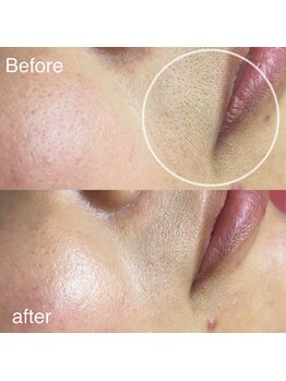 コモドアイラッシュ(comodo eyelash)/マリムーブフェイシャルワックス