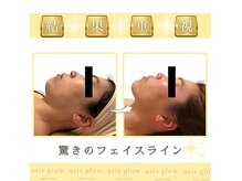 エイシスグロウ(asis glow.)の雰囲気（脂肪燃焼液導入×ハイサーマで抜群の効果出し★）