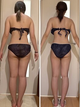 パルティール 恵比寿店(partir)/まあるい背中もスッキリ華奢に♪