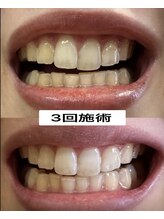 ガーディー(GaDaY)/3回施術例◎