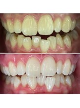 ホワイトニングサロン クルー(CREW)/