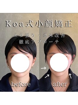 コア 心斎橋 堀江店(koa)/お客様ビフォーアフター