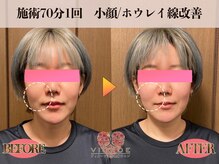 ヴィオーデ美容整体サロン 横浜店/小顔、リンパ、ヘッドスパ、整体