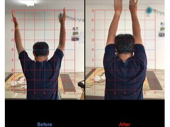 ストレチックス 近江八幡店/before/after