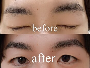 シエナ アイ(CIENA eye)/