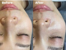 クリスタルビューティ 渋谷/NEW【XE'LHAセラピール】