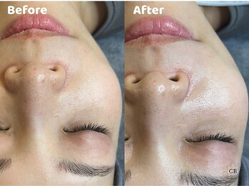 クリスタルビューティ 渋谷/NEW【XE'LHAセラピール】