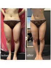 ピーラトゥ 日立(P-Ratu)/下半身集中◎