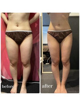 ピーラトゥ 日立(P-Ratu)/下半身集中◎